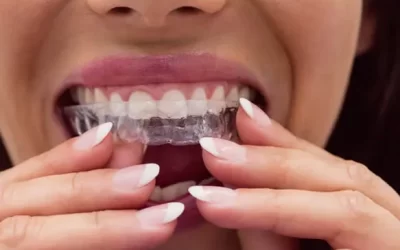 Invisalign Mission Hills: Clear Aligner Therapy for Discreet Orthodontic Correction